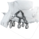 Implantologia iuxta-ossea con l’IMPIANTO SUBPERIOSTALE