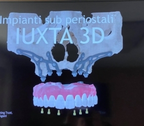 riabilitazione con IUXTA 3D 27022021 (3)